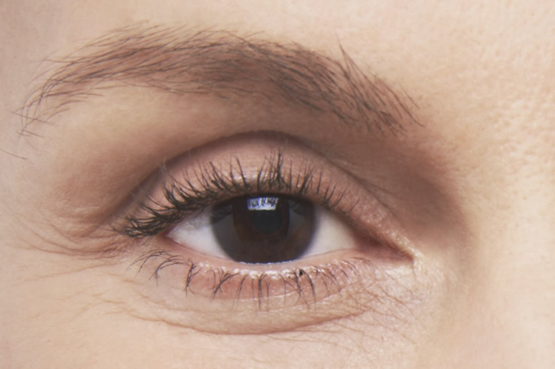 Blepharoplasty (Eyelid Surgery)